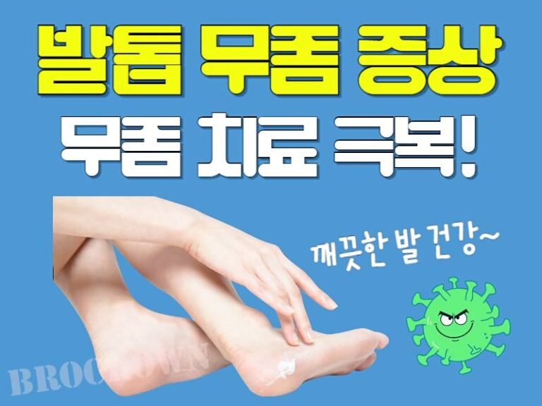 발톱 무좀 증상