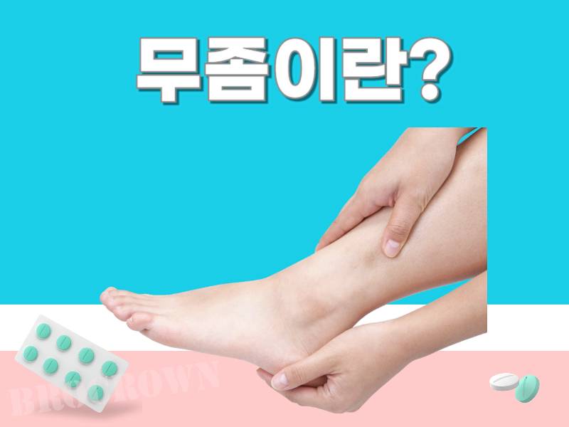 발톱 무좀