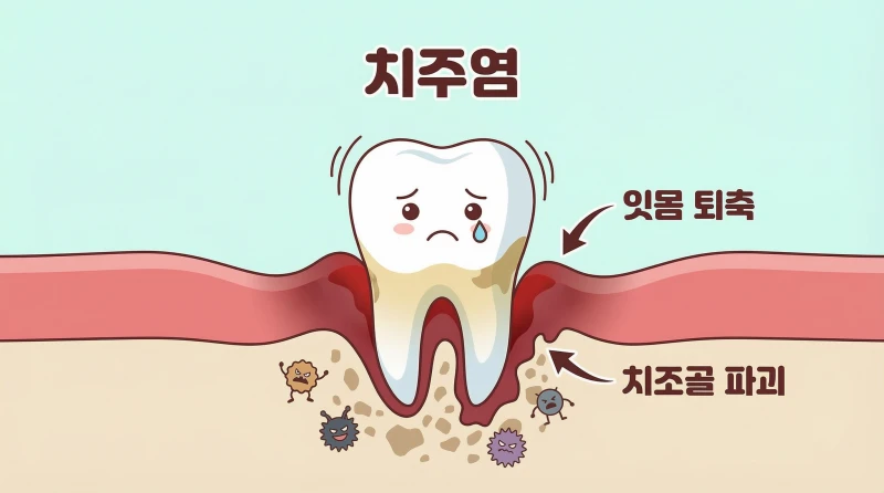잇몸사이 고름10 잇몸사이 고름